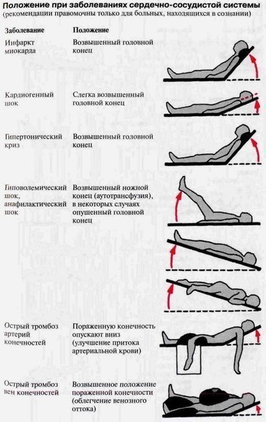 Изголовье операционного стола не рекомендуется приподнимать выше чем на тест